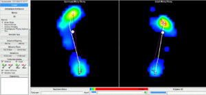 Θερμικός χάρτης πίεσης πελμάτων κατά τη βάδιση, με χρωματική κλίμακα έντασης και γραμμή τροχιάς του κέντρου πίεσης για κάθε πόδι.